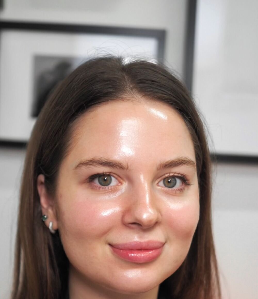 Fresh, radiant skin after a Queen of Beauty facial treatment